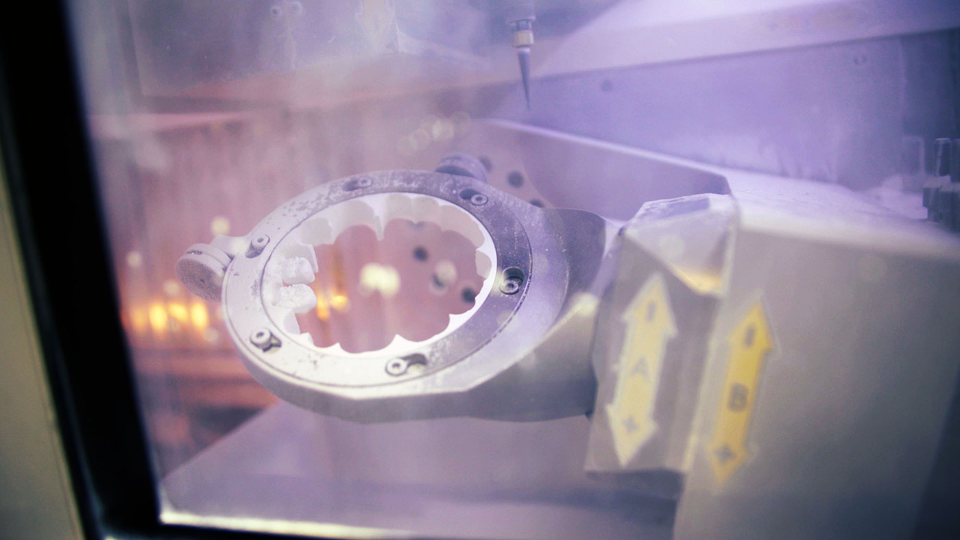 CAD/CAM Precision Milling Technology | Valley Dental Arts