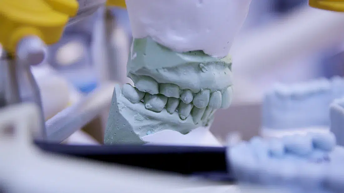 Case Planning Valley Dental Arts