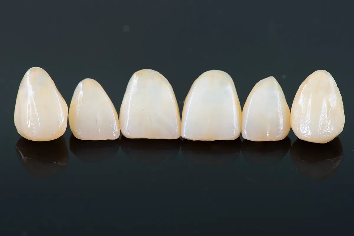 crowns