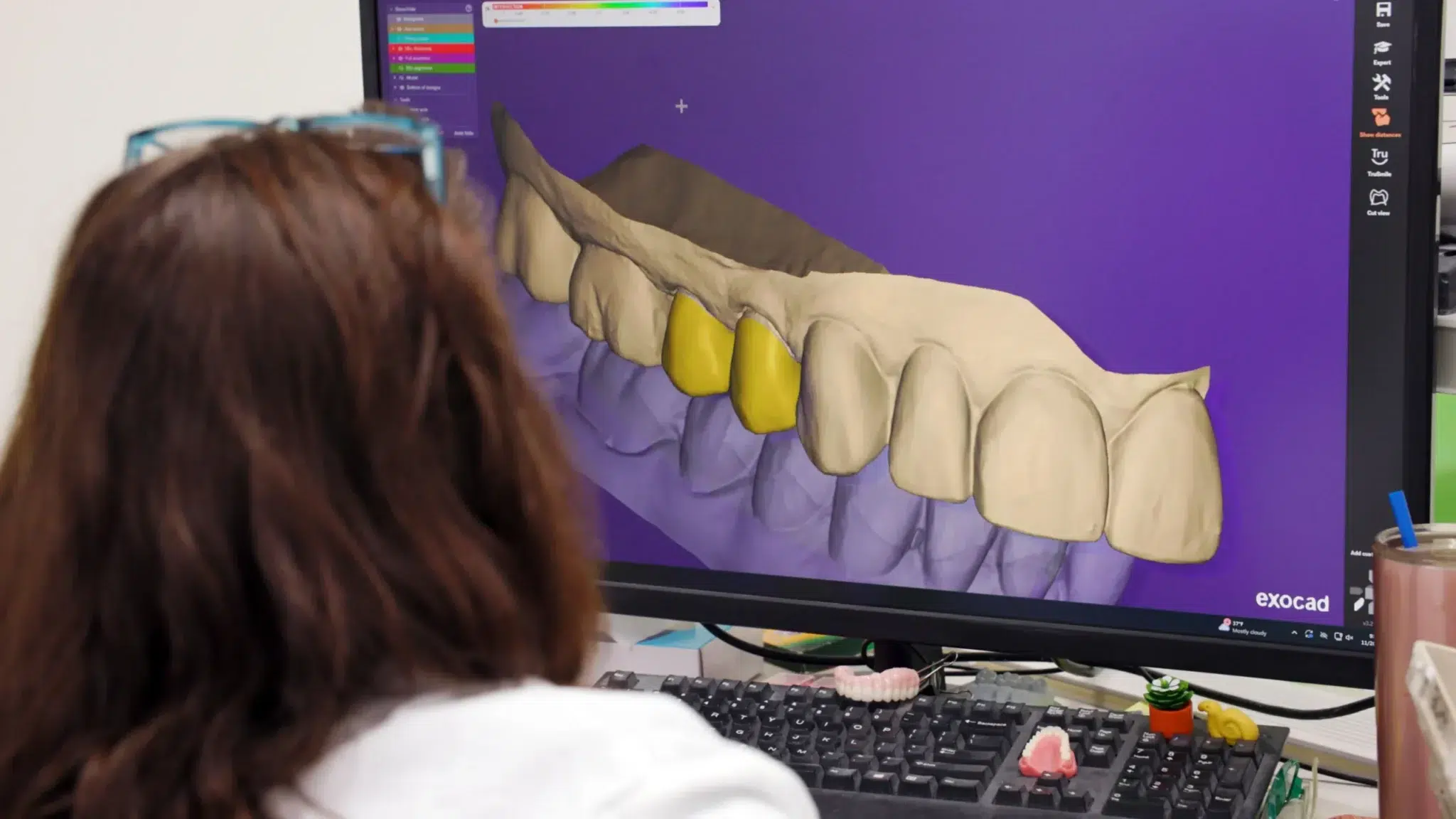 exocad scaled